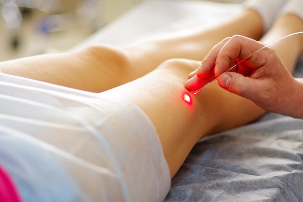 laserterapia aplicada nas pernas